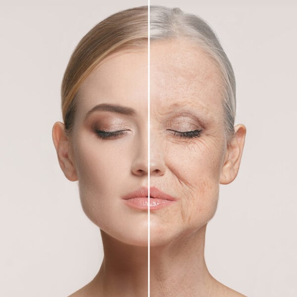 Obagi NuDerm Facial Bromley
