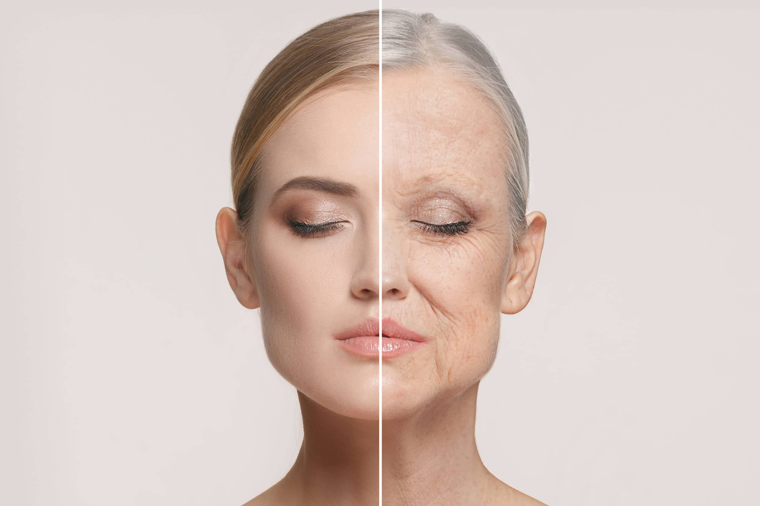 Obagi NuDerm Facial Bromley