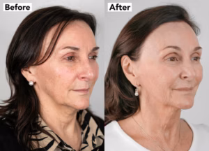 Shirley Ballas NeoGen Bromley