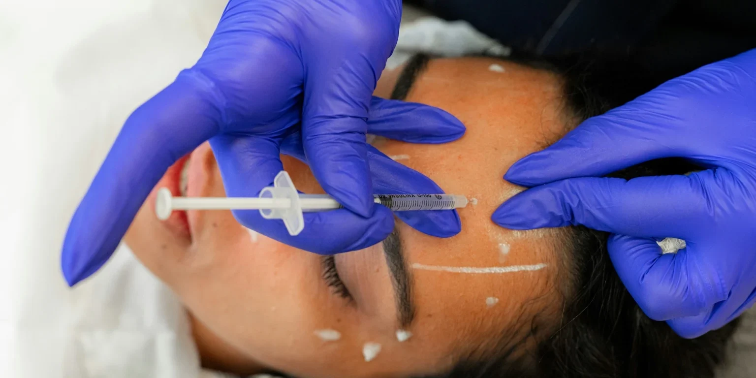 Woman recieving a Botox Treatment in Bromley for Forehead Wrinkles